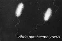 顕微鏡写真：腸炎ビブリオ（写真提供：東京都　健康安全研究センター）