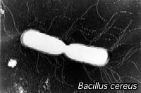 顕微鏡写真：セレウス菌（写真提供：東京都　健康安全研究センター）