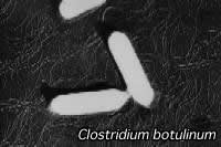 顕微鏡写真：ボツリヌス菌（写真提供：東京都　健康安全研究センター）