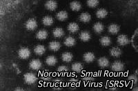 顕微鏡写真：ノロウィルス（写真提供：東京都　健康安全研究センター）